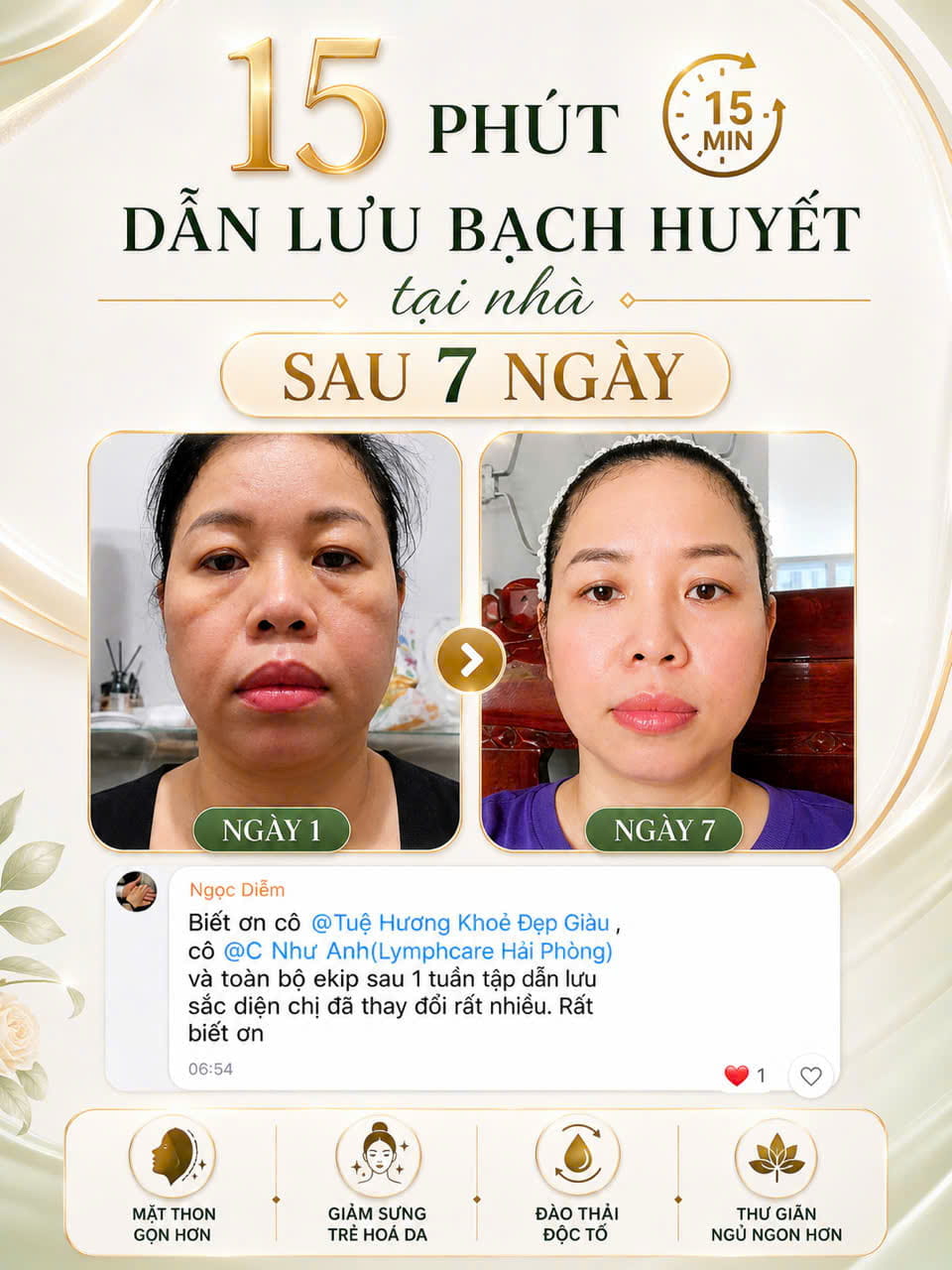 Kết quả dẫn lưu bạch huyết tại nhà sau 7 ngày của chị Ngọc Diễm