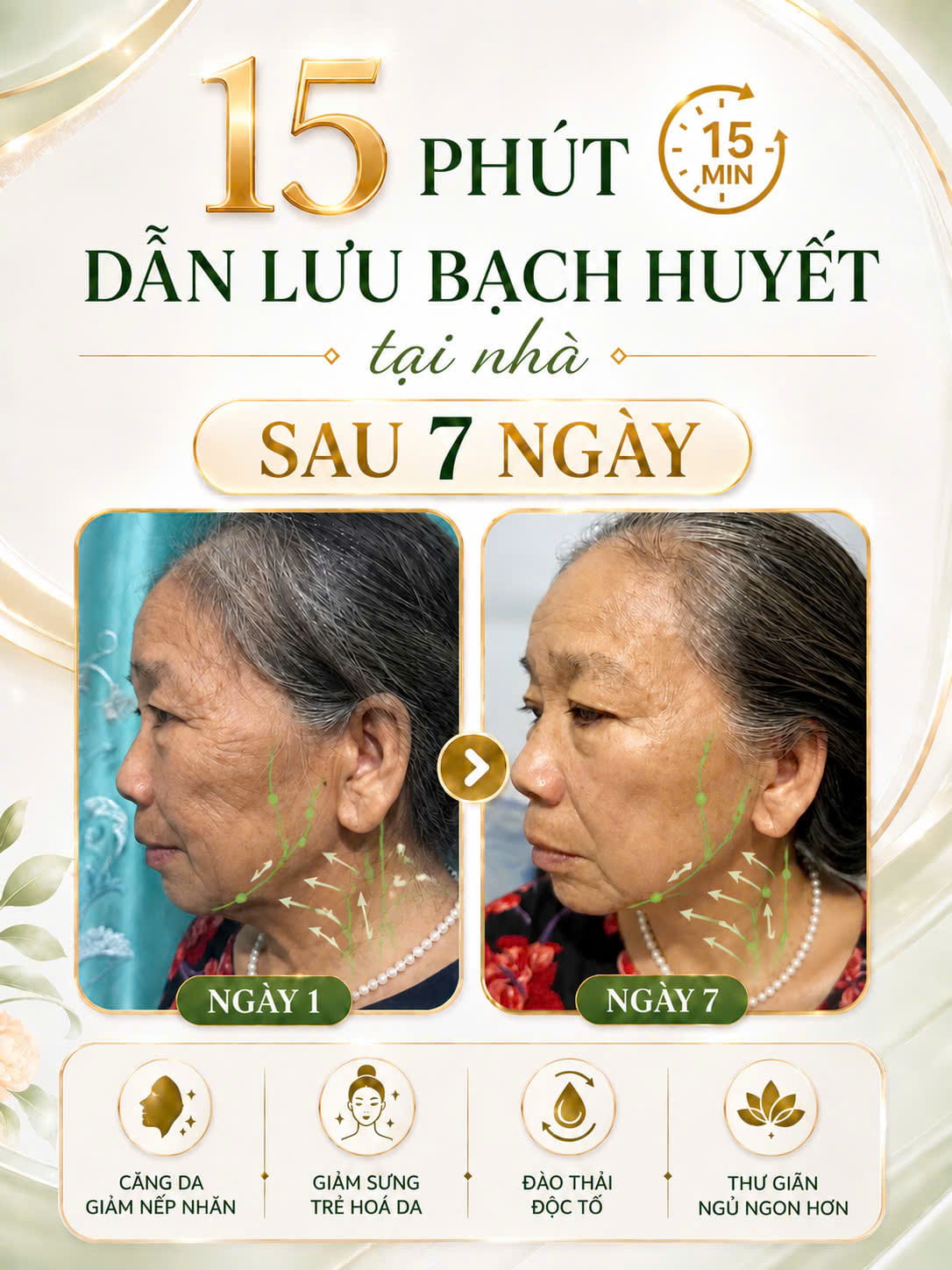 Học viên dẫn lưu bạch huyết vùng cổ - căng da, giảm nếp nhăn sau 7 ngày