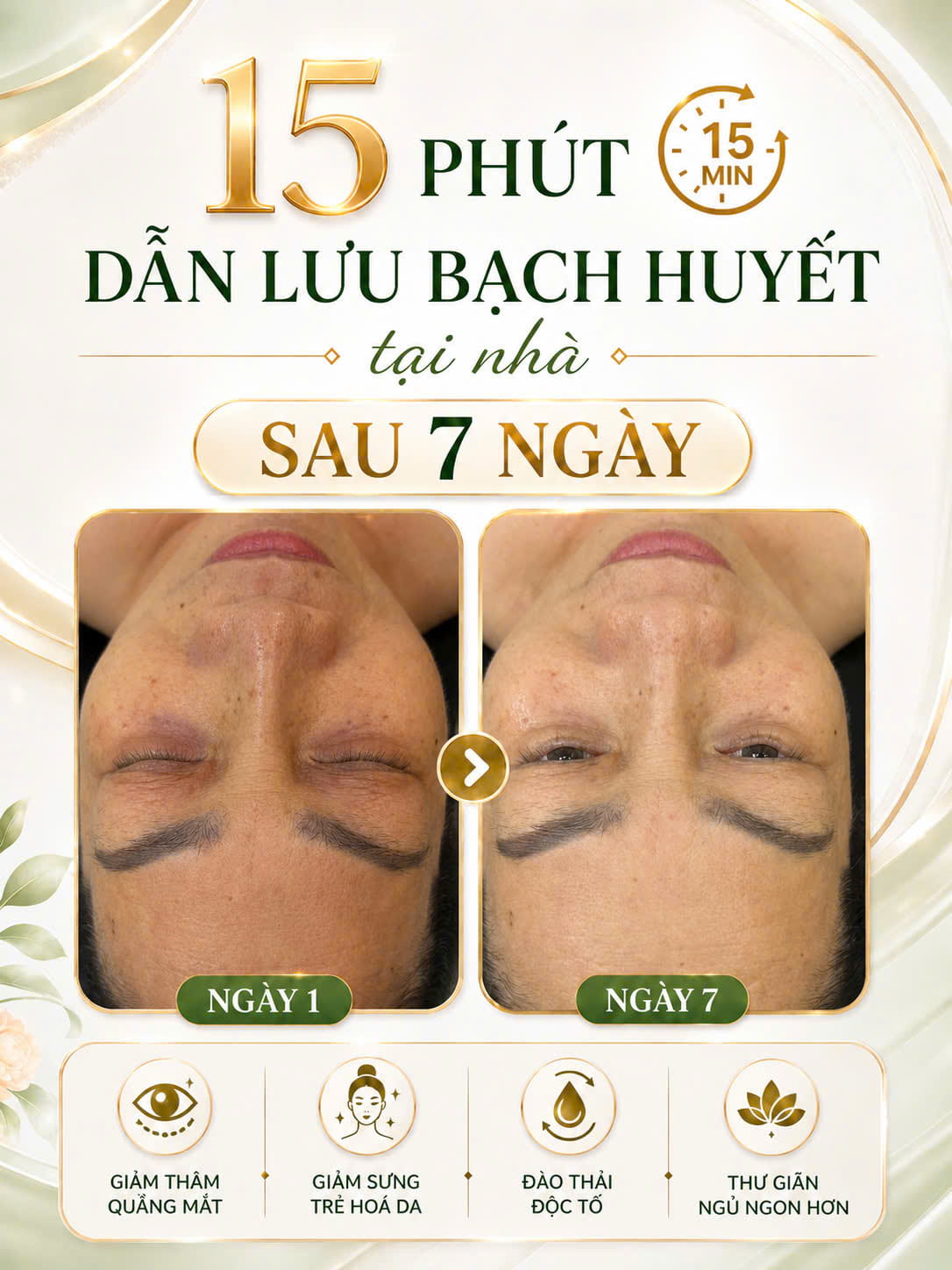Học viên dẫn lưu hệ bạch huyết - đường nét gương mặt sáng rõ sau 7 ngày