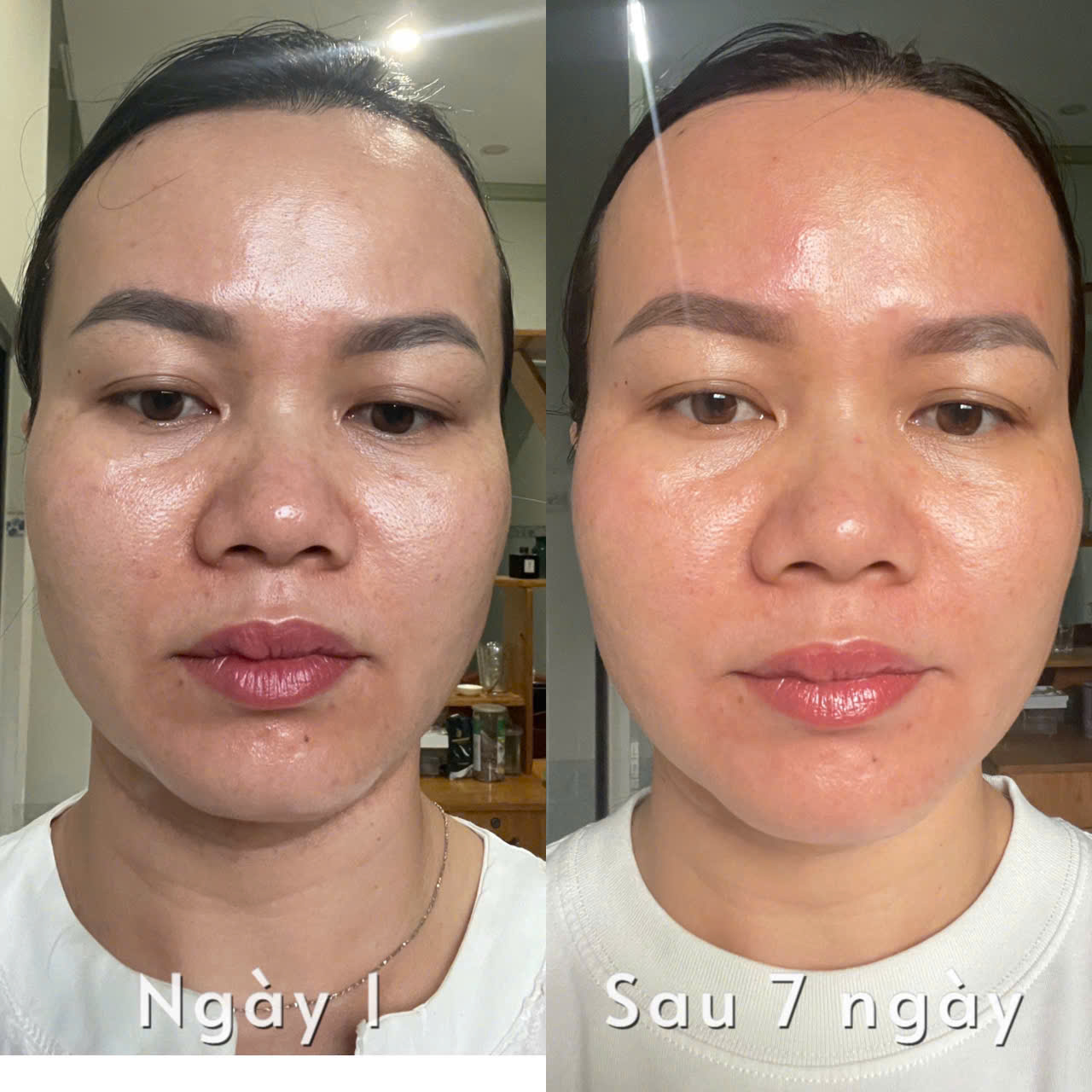 Học viên dẫn lưu bạch huyết - closeup Ngày 1 và Sau 7 ngày, da căng và sắc diện sáng rõ