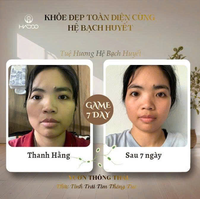 Thanh Hằng - kết quả Game 7 Day dẫn lưu bạch huyết sau 7 ngày, da sáng và đường nét gọn gàng